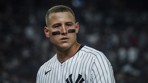 Yankees Notebook: Anthony Rizzo showing signs of progress post-concussion